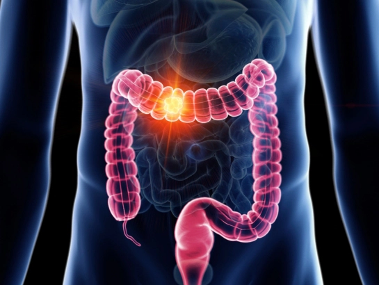 gastrointestinal-cancers-near-Somajiguda