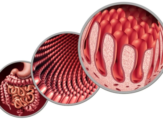 intestinal-bstruction-perforation-near-Somajiguda