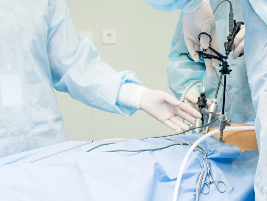 laparoscopic-surgery -near-Somajiguda